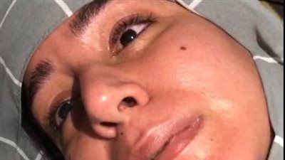 حياة ضحية زوجها في الدقهلية: سحلني في نص الليل وقالي مش هسيبك غير لما اعمل عاهة - الخليج الان