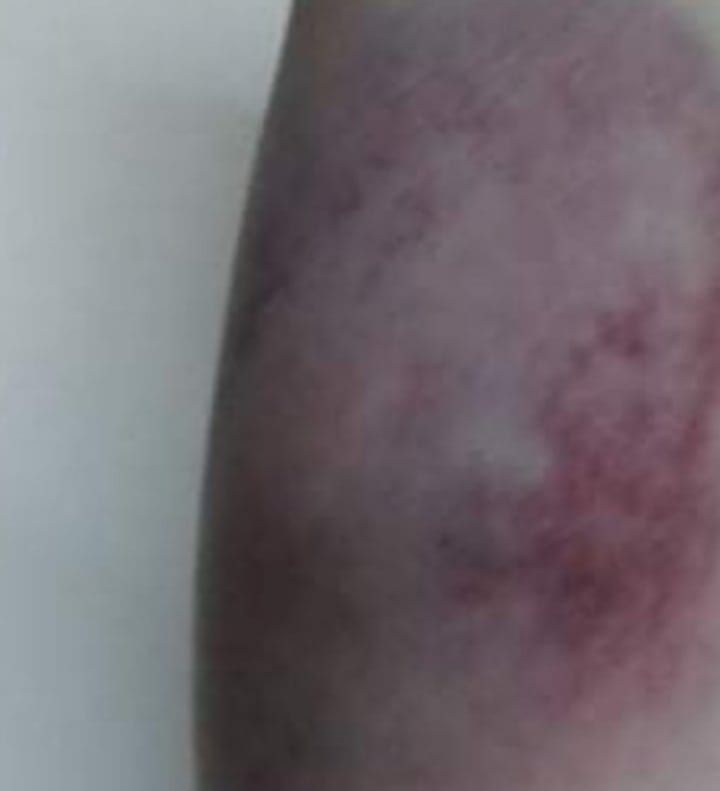 أسرة آية عادل عن عرض زوجها أموالا عليهم للتنازل: كنوز الدنيا متكفيش دم بنتنا - الخليج الان