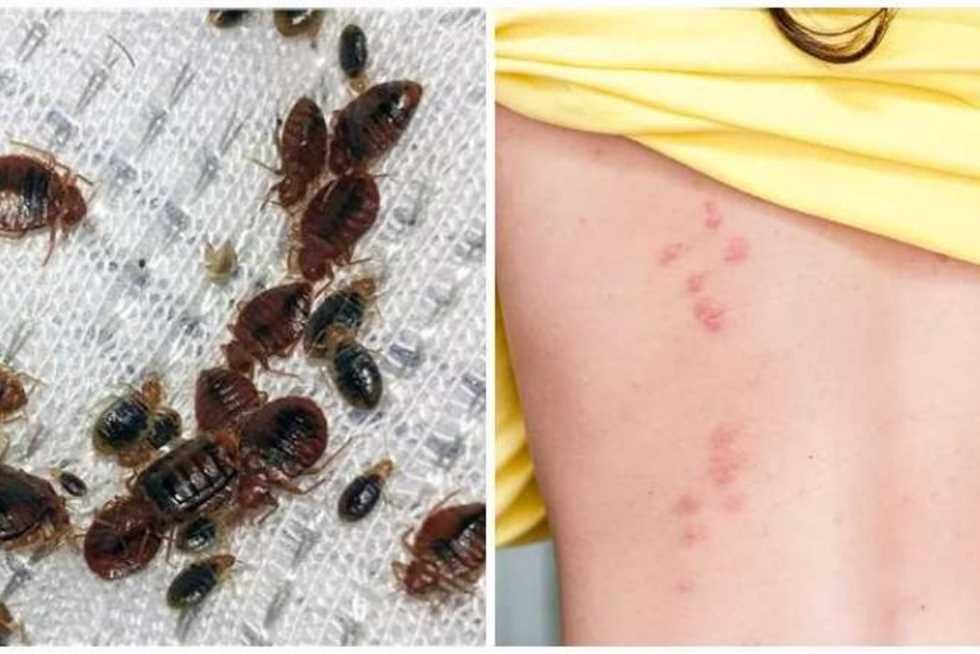 مكافحة فعّالة.. التخلص من بق الفراش سريع ونهائي