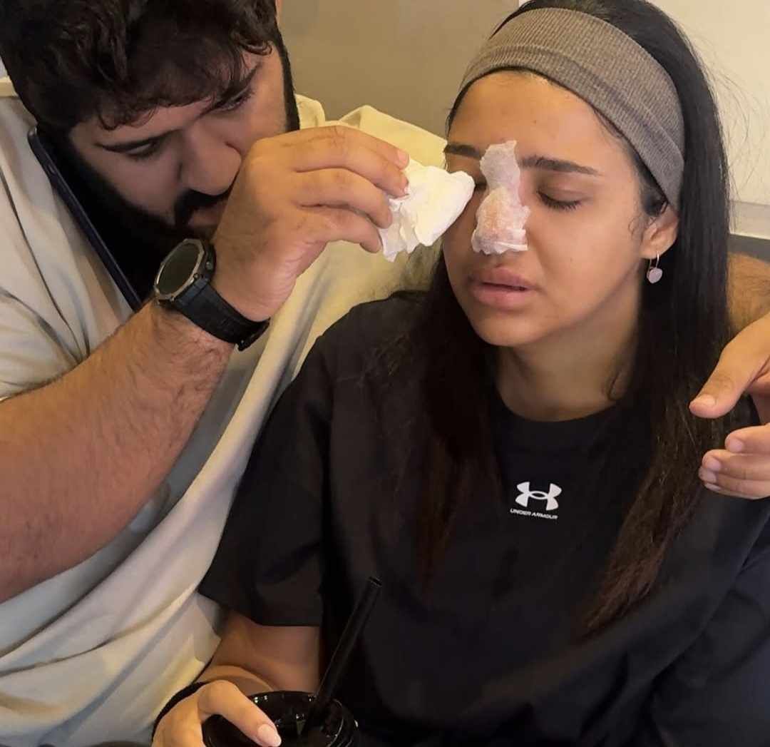 كنزي مدبولي تتعرض لخطأ طبي: مناخيري كانت هتروح بسبب حقنة فيلر - الخليج الان