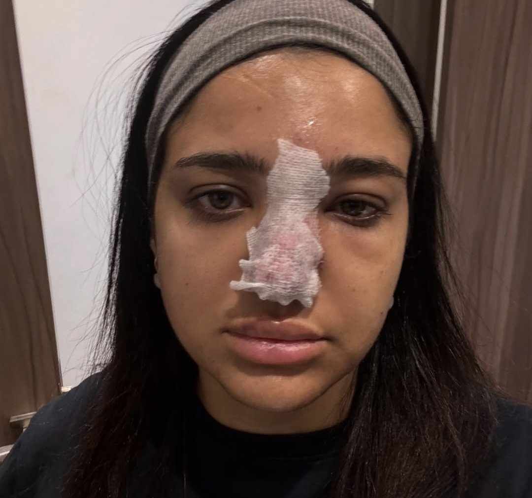 كنزي مدبولي تتعرض لخطأ طبي: مناخيري كانت هتروح بسبب حقنة فيلر - الخليج الان