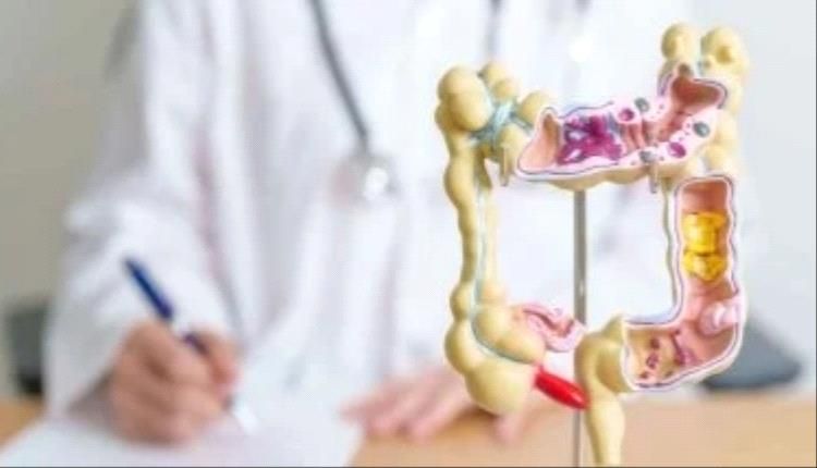 ارتفاع معدلات الإصابة بسرطان القولون بين الشباب.. أطعمة يجب تجنبها