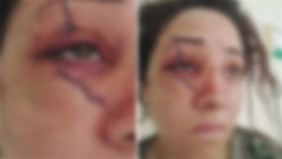 ضبط زوج مزق جسد زوجته بسبب خلافات على النفقة بالمحلة - الخليج الان