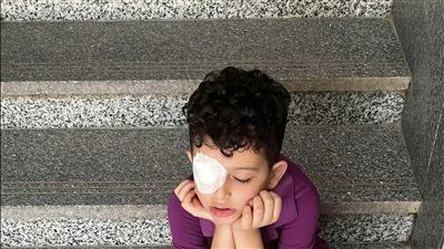 واقعة مؤسفة.. إصابة تلميذ بجرح في القرنية بعد اعتداء معلمة عليه بكتاب في مدرسة لغات بالدقهلية - الخليج الان