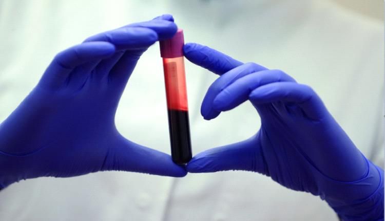 إنذار مبكر للسرطان !