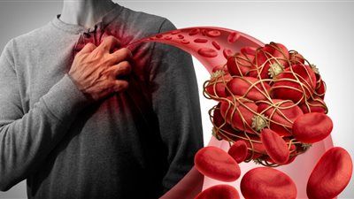 فن إدارة التوتر.. دراسة: الحزن يهدد حياتك بالجلطات - الخليج الان