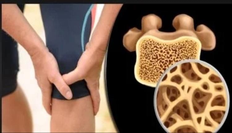 الفرق بين التهاب المفاصل الروماتويدي وهشاشة العظام: الأسباب والأعراض