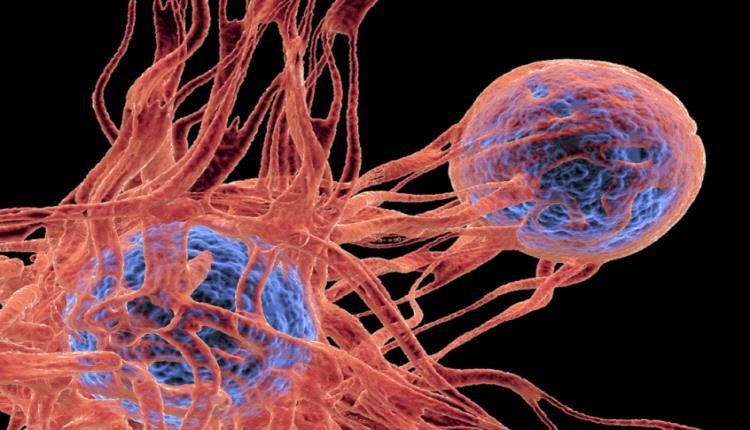 نقلة نوعية في علاج السرطان !