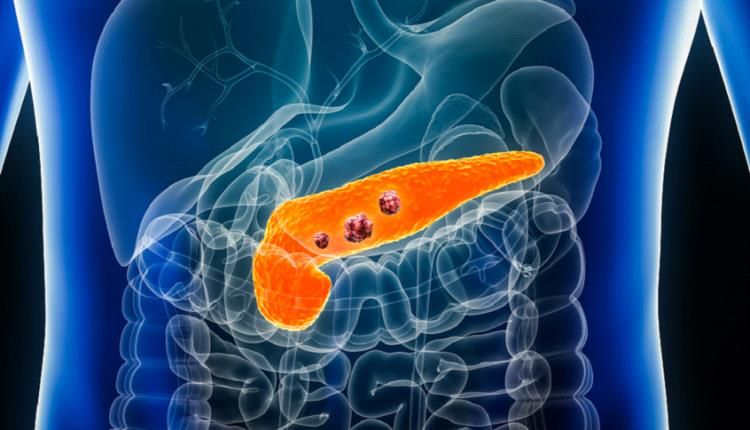 اكتشاف جديد قد ينقذ الكثير من أخطر أنواع السرطان !