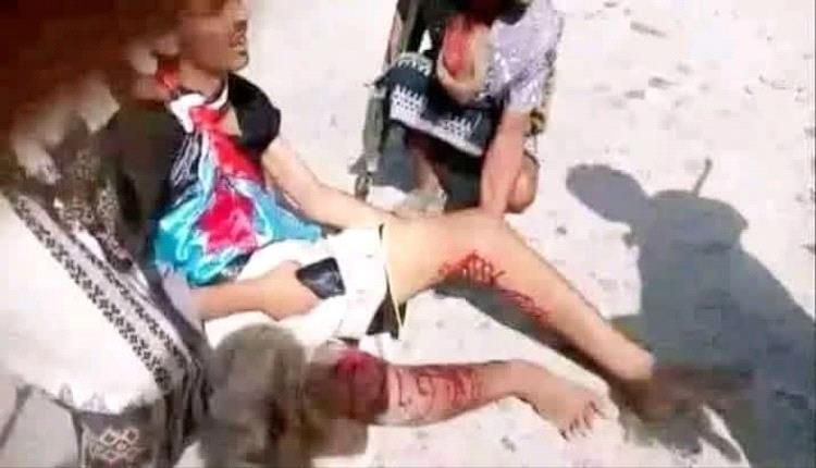 عاجل : هجوم وحشي تشنه قوات الغزو اليمني على متظاهرين حضارم وجرحى ينزفون