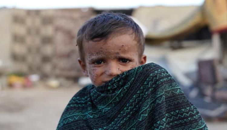 مركز حقوقي: أكثر من 2.1 مليون إصابة مرضية وانهيار 70% من المختبرات في غزة وسط حرب الإبادة