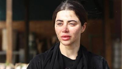 يارا السكري: شخصية "روح" في "علي كلاي" تجربة جريئة خارج إطار الأدوار التقليدية - الخليج الان