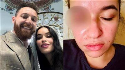 اداني علقة موت.. زوجة محمود حجازي تزعم: مش بيصرف على ابنه - الخليج الان