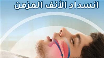 انسداد الأنف .. 7 طرق منزلية فعالة لعلاج الجيوب الأنفية وتخفيف الصداع بسرعة - الخليج الان