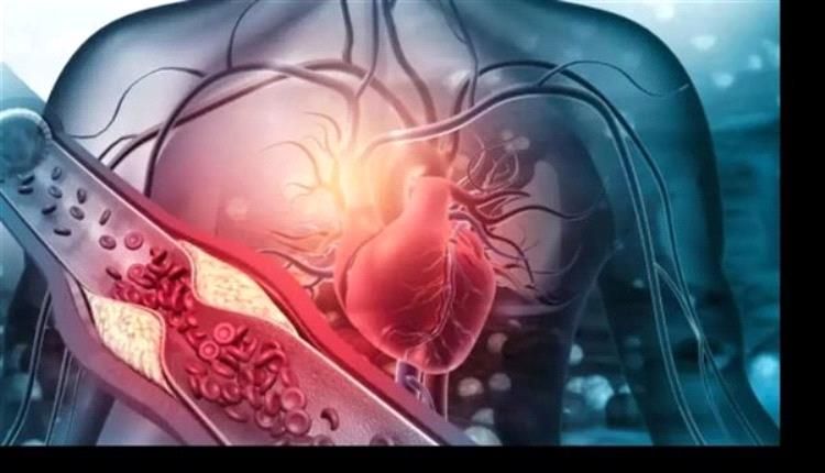 مشروبات شائعة تهدد صحة القلب