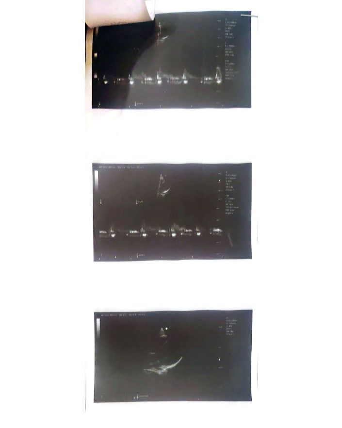 بالمستندات اتحاد الجمباز يكشف حقيقة إصابة سلمى المنشاوي - الخليج الان