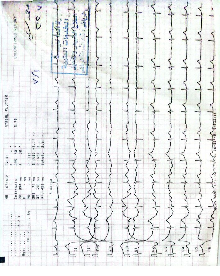 بالمستندات اتحاد الجمباز يكشف حقيقة إصابة سلمى المنشاوي - الخليج الان