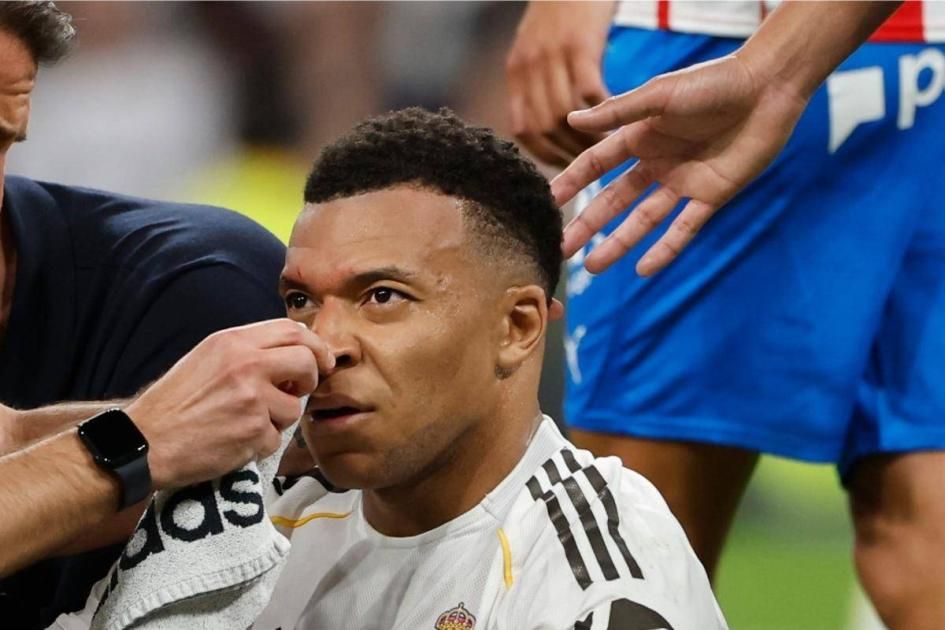 لماذا اختفى «الدم» الذي فجّر وجه مبابي أمام الكاميرات؟