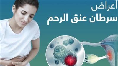 “انجاز طبي وشيك ”.. هل أقتربت نهاية سرطان عنق الرحم ؟ - الخليج الان