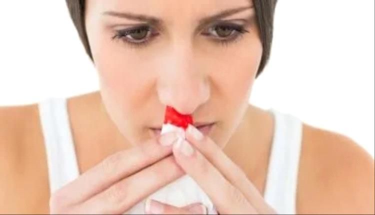 إسعافات أولية لنزيف الأنف الناتج عن حرارة الصيف.. ومتى يجب القلق؟