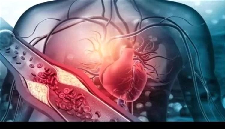 طرق الوقاية من أمراض صمامات القلب مع التقدم في العمرصحة القلب صحة وطبصحة القلب