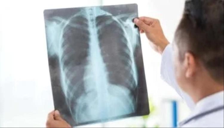 الالتهاب الرئوى.. علامات تحذيرية مبكرة قد تنقذ حياتك من عدوى خطيرة