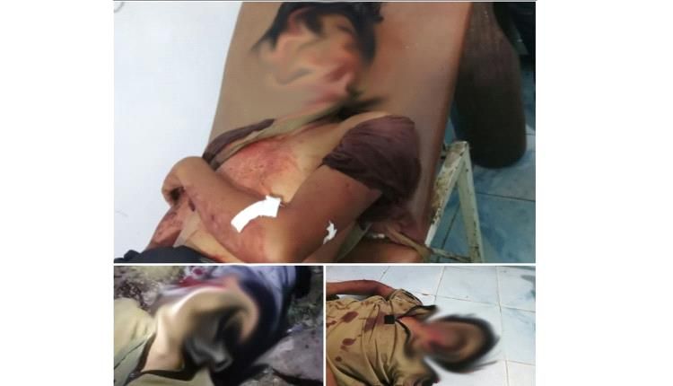 مقتل شخصين وجرح ثالث في كمين مسلح خلف مجمع المصري بالضالع