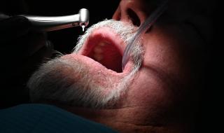 سوء الأوضاع الاقتصادية يدفع إيرانيين إلى قلع الأسنان بدلا من ترميمها