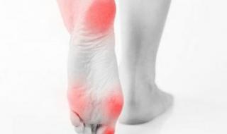 ثقل الساقين في الصيف.. الأسباب وطرق الوقاية والعلاج - الخليج الان