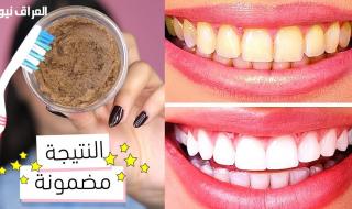 من غير كيماويات ولا وجع خلطات طبيعية تبيض الأسنان بأمان