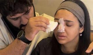 كنزي مدبولي تتعرض لخطأ طبي: مناخيري كانت هتروح بسبب حقنة فيلر - الخليج الان