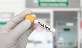 فضائح الأبوة في أوغندا.. تحاليل DNA تكشف أسرار العائلات الصادمة - الخليج الان